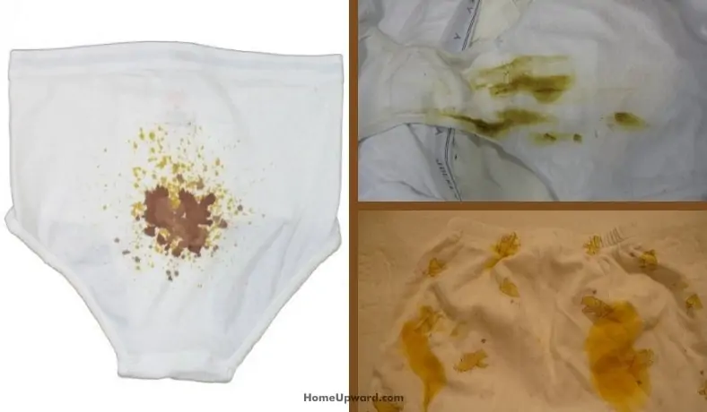 how to remove feces stains from underwear featured image